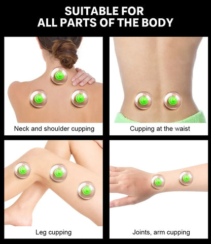 Vacuum Cupping Set