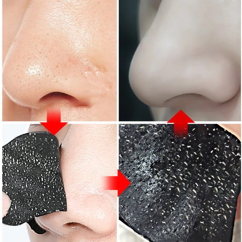 Deep Cleansing Nose Strips